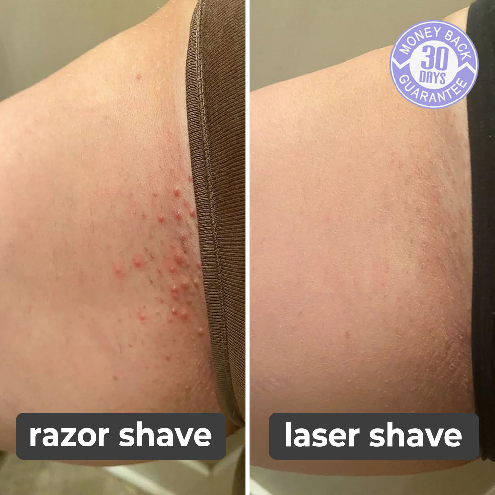 SilkySkin Laser Hair Remover
