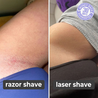 SilkySkin Laser Hair Remover